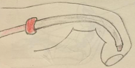 Schéma dessiné à la main d’un doigt fléchi, le tendon butant sur la poulie rouge