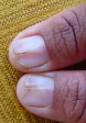 Photographie rapprochée de deux extrémités de doigts, ongles d’aspect légèrement irrégulier