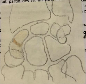 Croquis au crayon des os du carpe, le scaphoïde étant coloré en orange